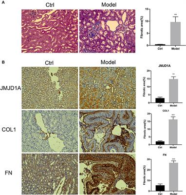 JMJD1A/NR4A1 Signaling Regulates the Procession of Renal Tubular Epithelial Interstitial Fibrosis Induced by AGEs in HK-2